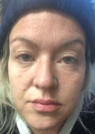 Moville woman Natasha Crumlish has lashed out at the Health Service