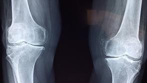 Four Donegal hospitals get grants to upgrade x-ray equipment