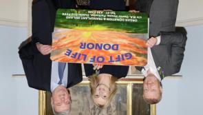 190 organ transplants were performed in Ireland in 2020
 