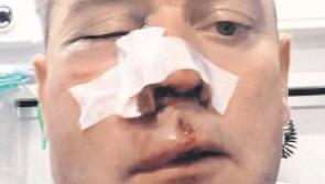 Four men to face charges for assault on Donegal referee 