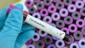 Part of new coronavirus test is being developed in Donegal