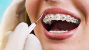 Action urged to tackle Donegal's “notorious” orthodontic waiting lists