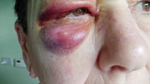 Donegal woman seriously injured after fall