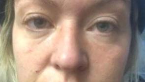 'The Health Service is broken' - Natasha Crumlish