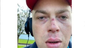 Brother wants help to identify "scumbags" who assaulted his autistic brother


