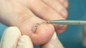 UPDATE: HSE refute claim that podiatry services have been removed from Ballyshannon 