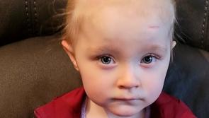 Family raise funds for hospital after Buncrana girl’s scoliosis diagnosis