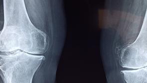 Residents in Donegal nursing homes to avail of new free mobile X-ray service
