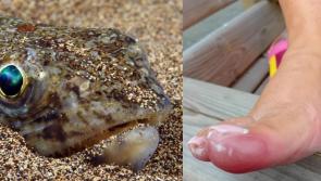 Warning after local woman stung by potentially lethal fish on Buncrana beach