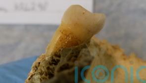 National: Brushing up on the Bronze Age as 4,000-year-old tooth found 