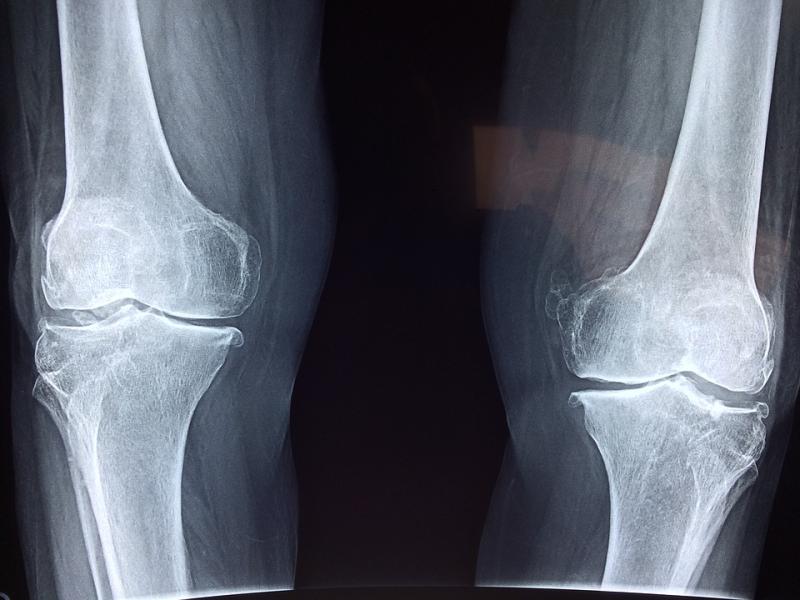 Four Donegal hospitals get grants to upgrade x-ray equipment