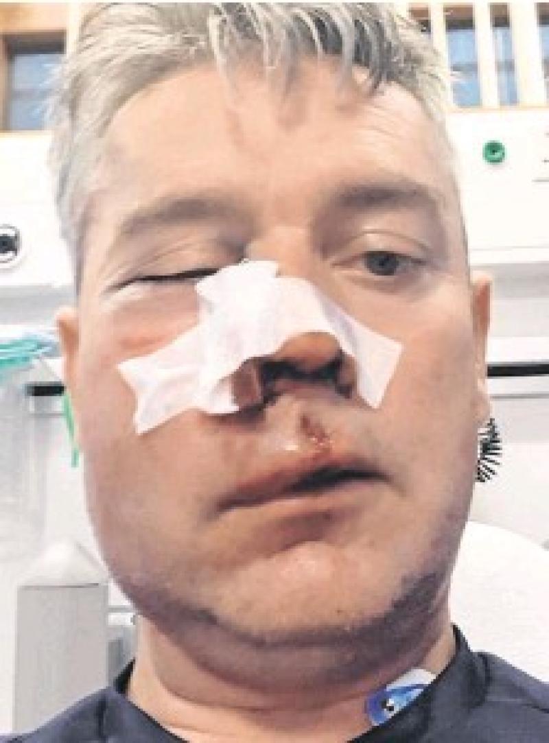 Four men will face charges following November assault on referee Daniel Sweeney from Donegal