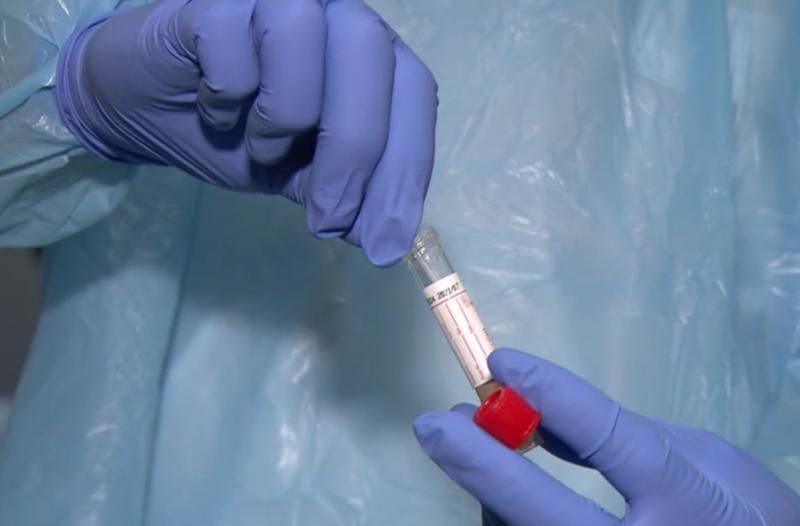 coronavirus covid-19