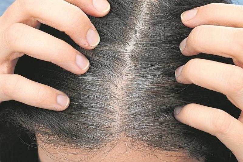 Hair column