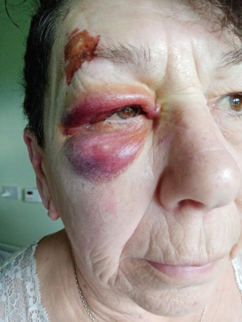 Kay Lattimore's injuries following a fall in Holywell Retirement Village