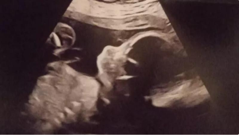 Baby Theo