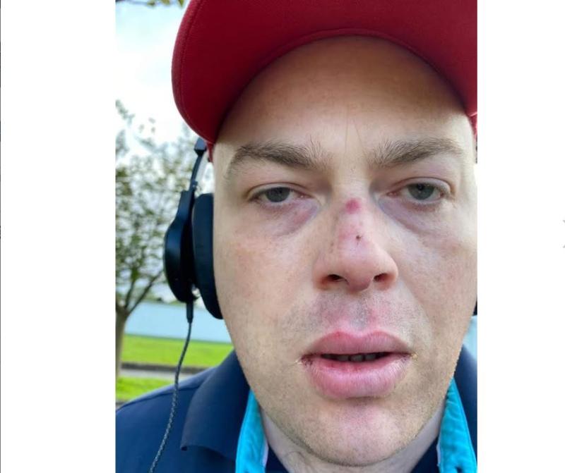 Brother wants help to identify "scumbags" who assaulted his autistic brother