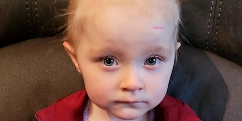 Family raise funds for hospital after Buncrana girl’s scoliosis diagnosis