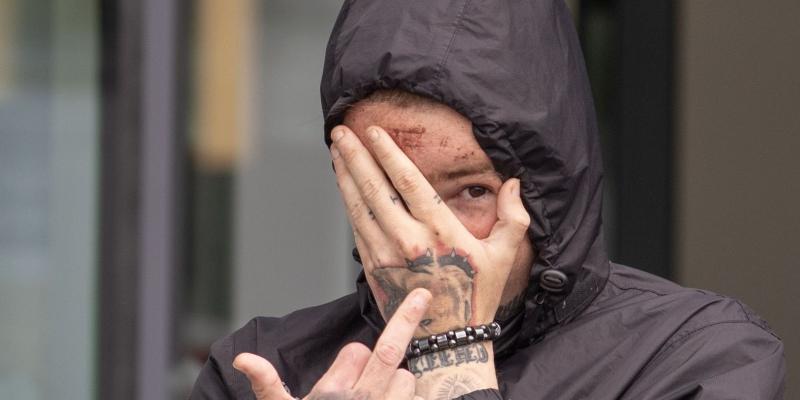 Man in court over serious assault in Castlefin