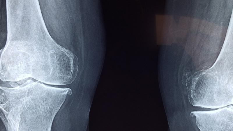 Residents in Donegal nursing homes to avail of new free mobile X-ray service