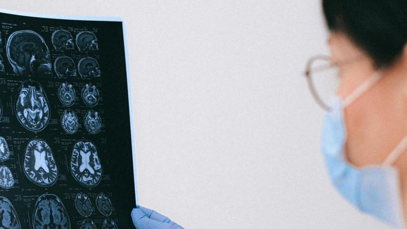 Brain Awareness Week: Never too late - or early - to start looking after your brain