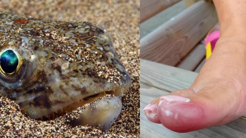 Warning after local woman stung by potentially lethal fish on Buncrana beach