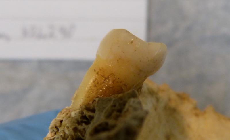 National: Brushing up on the Bronze Age as 4,000-year-old tooth found 